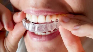 How Orthodontic Treatment Affects Athletic Performance and Sports Safety